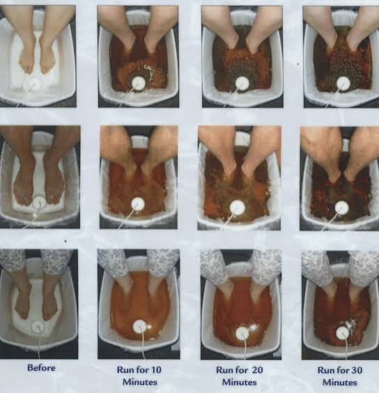 Ionic Foot Bath Detox - All - Natural Healing Store